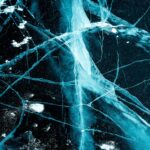 Neural Lace: Weaving a Smarter, More Connected Future